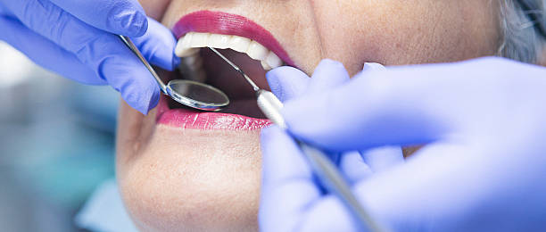 Best Chipped Tooth Repair Near Me  in Chino, CA